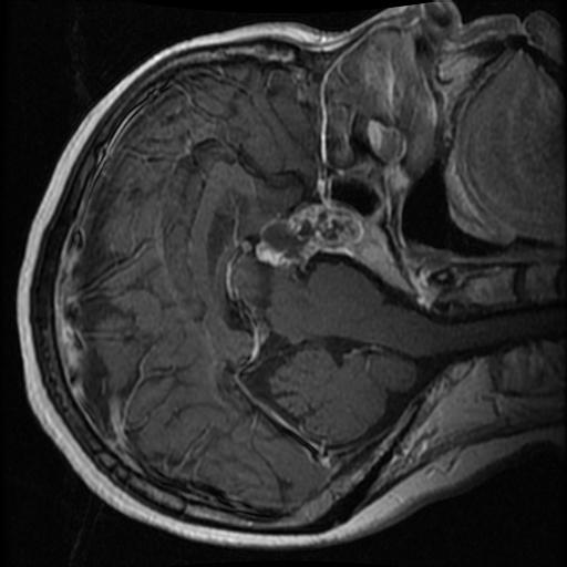 NeuralBlack Medical AI